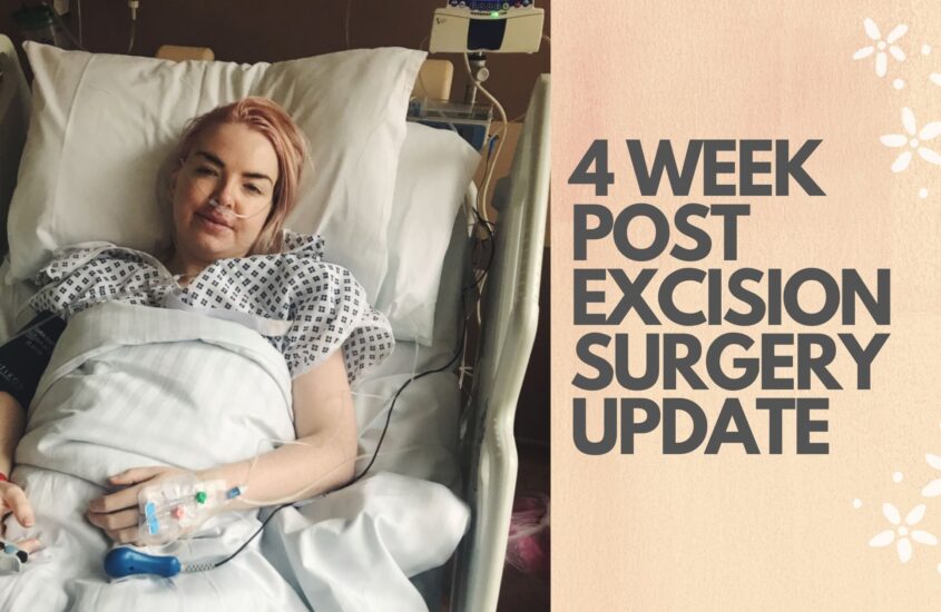 4 week post Excision surgery update